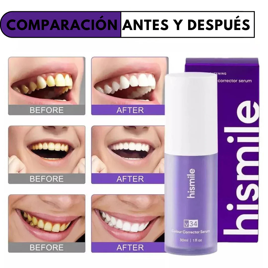 HISMILE - BLANQUEADOR DENTAL 🦷