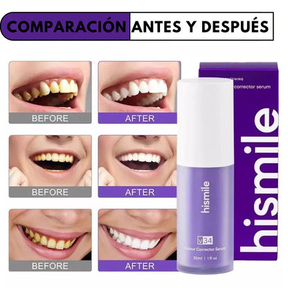HISMILE - BLANQUEADOR DENTAL 🦷